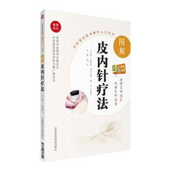 图解皮内针疗法/中医适宜技术操作入门丛书